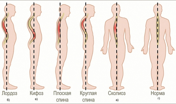 Позвоночник человека лордоз кифоз