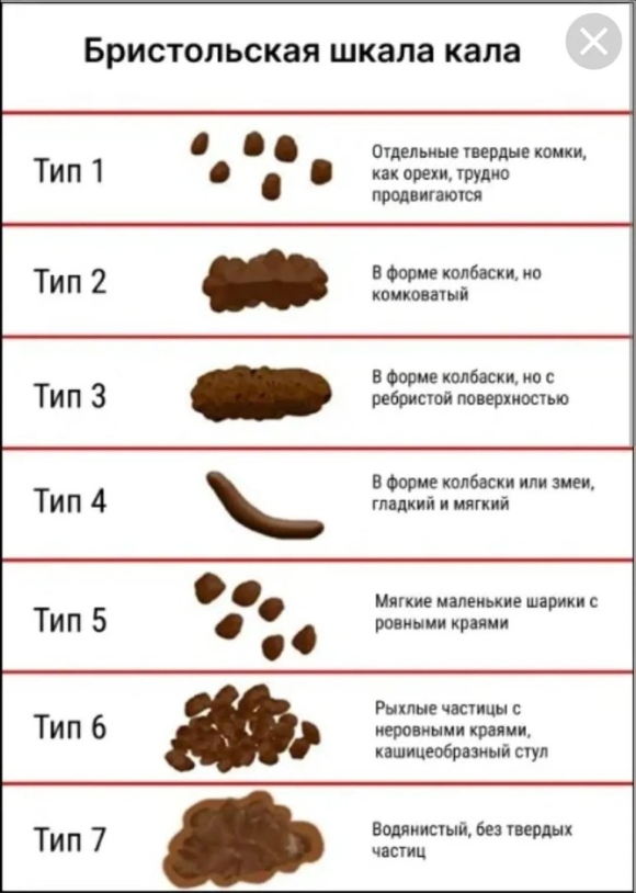 Бристольская классификация кала