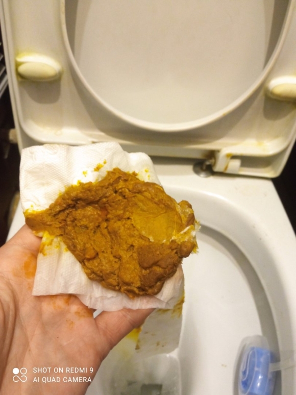 Желтые какашки у взрослого
