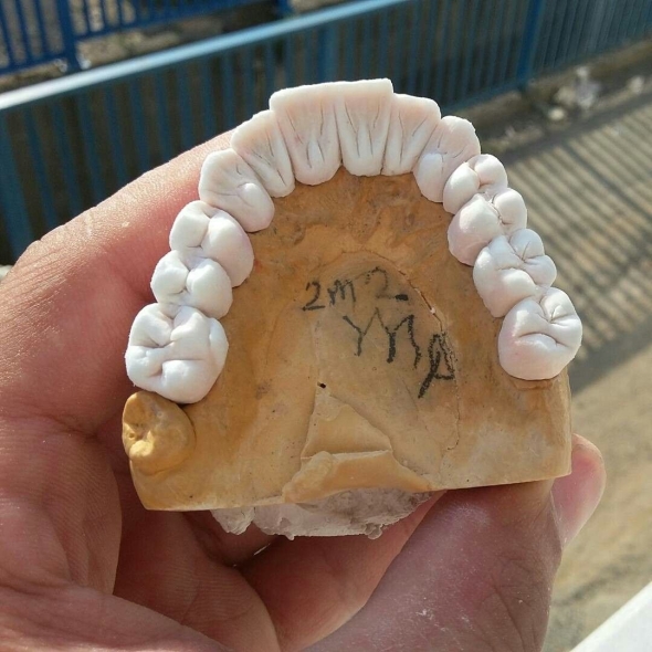 Зубной техник зубы